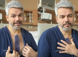 Otaviano-Costa-relembra-cirurgia-apos-aneurisma-e-medico-alerta-Alto.png